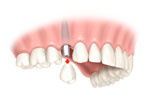 Image for Advanced Prosthodontics with ID of: 875675