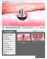 Image for Advanced Prosthodontics with ID of: 875676
