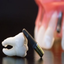 Image for Uni-Dent Laboratory with ID of: 880831
