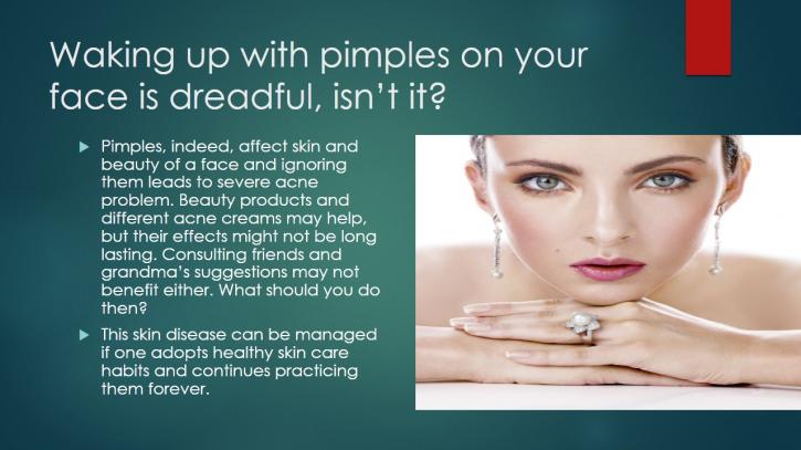 Image for Six Ways to Abate Acne & Pimples with ID of: 883351