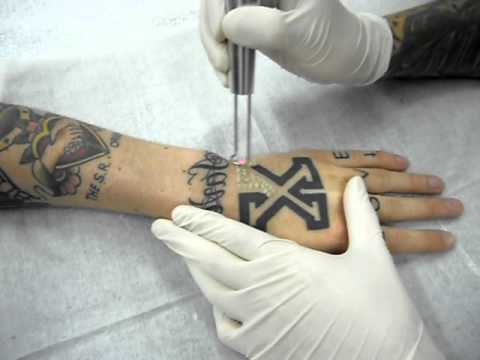 Image for Morphd with ID of: 887544