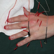 Image for Columbia Acupuncture with ID of: 891015