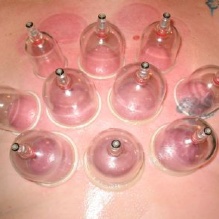 Image for Columbia Acupuncture with ID of: 891016