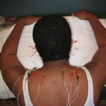 Image for Columbia Acupuncture with ID of: 891017