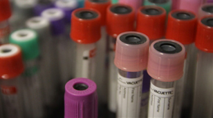 Image for Creative Bioarray with ID of: 906173