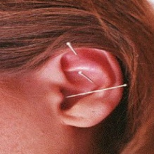Image for Patty Johnson's Acupuncture & Herbs with ID of: 913149