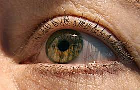 Image for Cataract surgery Boston with ID of: 925698