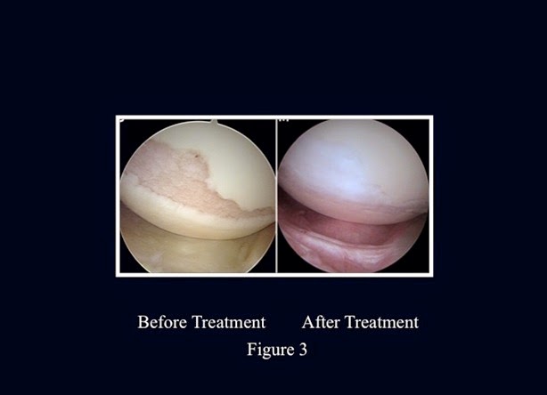Image for Dr. Jack Bert, MD Minnesota Bone & Joint Specialists with ID of: 931473