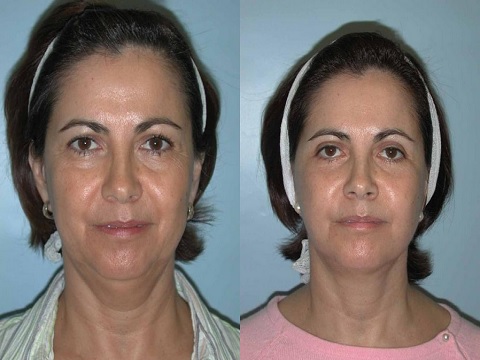 Image for Adam J. Rubinstein, MD, FACS with ID of: 936080