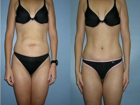 Image for Adam J. Rubinstein, MD, FACS with ID of: 936081
