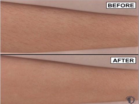 Image for Adam J. Rubinstein, MD, FACS with ID of: 936082