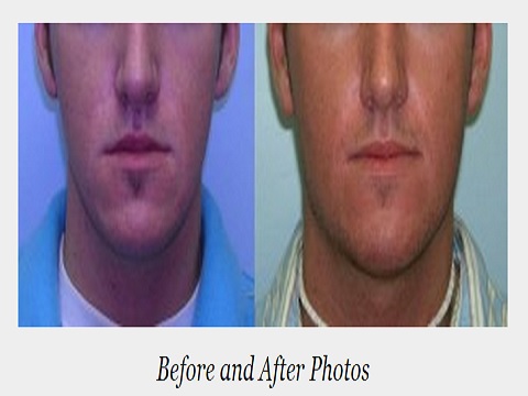 Image for Adam J. Rubinstein, MD, FACS with ID of: 936083