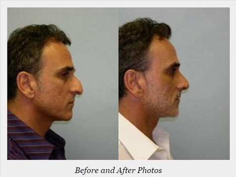 Image for Adam J. Rubinstein, MD, FACS with ID of: 936086