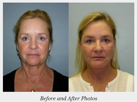 Image for Adam J. Rubinstein, MD, FACS with ID of: 936087