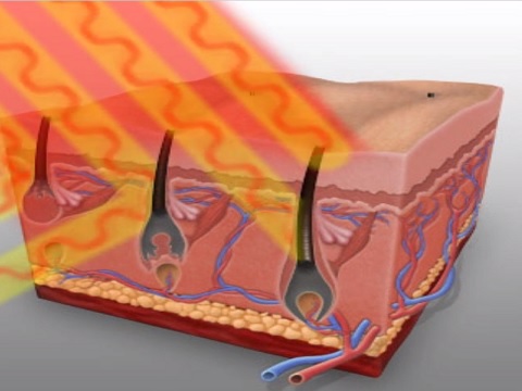 Image for Adam J. Rubinstein, MD, FACS with ID of: 936089