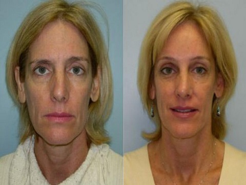 Image for Adam J. Rubinstein, MD, FACS with ID of: 936090