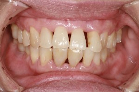Image for Timothy J. Butson, DMD, MSD with ID of: 938093