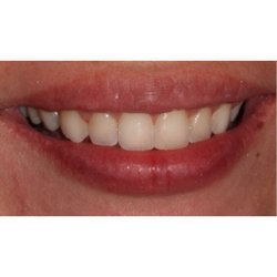 Image for Vaisman Anatoly DDS with ID of: 960681