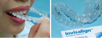 Image for Gets a pristine white smile by taking effective teeth whitening treatment in Dubai? with ID of: 960817