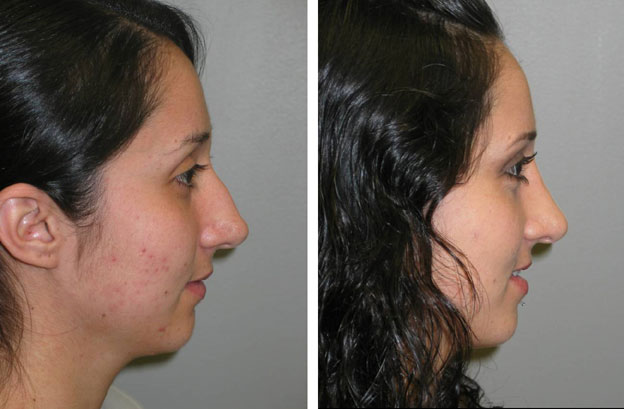 Image for Lloyd Krieger MD with ID of: 969734