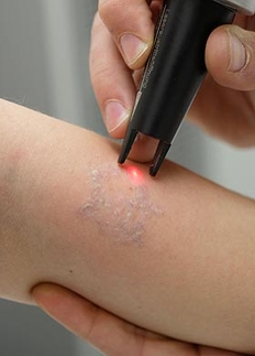 Image for Skin Deep Laser Services with ID of: 982011