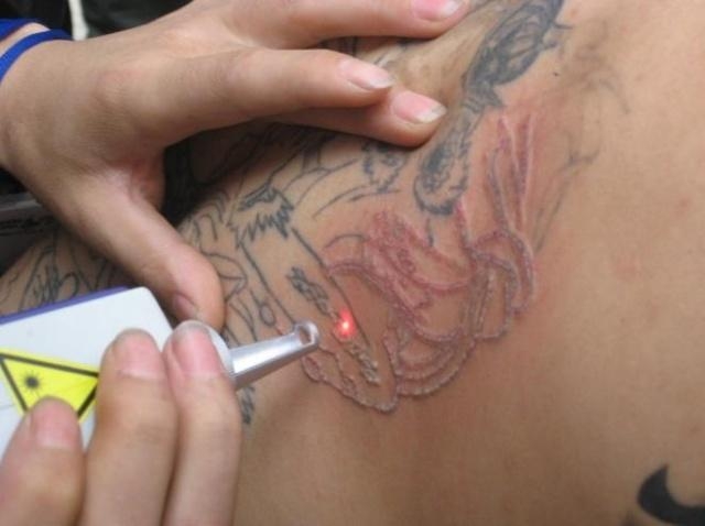Image for Skin Deep Laser Services with ID of: 982012