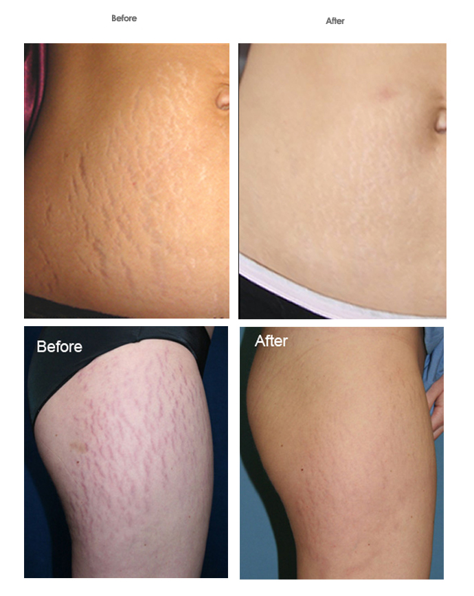 Image for Skin Deep Laser Services with ID of: 982013