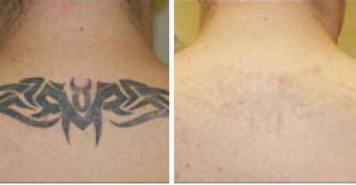 Image for Skin Deep Laser Services with ID of: 982014