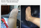 Image for Sprained ankle treatment with ID of: 986610
