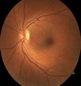 Image for Uptown Eyes with ID of: 996521