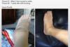 Photo for Sprained ankle treatment