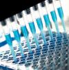 Photo for Antibody to Human Immunodeficiency Virus(1+2) ELISA Kit