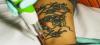 Photo for Eraser Clinic Laser Tattoo Removal