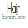 Photo for Affordable Hair Transplants Los Angeles