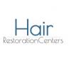Photo for Robotic Hair Transplants San Francisco
