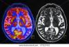 Photo for Biophotonics Market to Grow at 11.3% CAGR from 2014 to 2020 due to Government Support and Expanding Geriatric Patient Pool