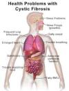 Photo for Global Kidney Fibrosis Treatment Market 2022 - Market Analysis, Share, Size, Regional Outlook, Forecast.Acute Market Reports