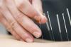 Photo for Best Acupuncture Clinic Malton & Brampton