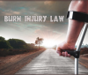 Photo for Burn Injury Law