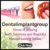 Photo for Look Younger with Dental Implants