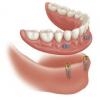 Photo for Implant Denture and Dental Center