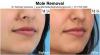 Photo for Mole Extermination