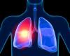 Photo for Cancer Diagnostics Market 2014 - 2020 Industry Perspective, Size Analysis and Forecast