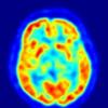 Photo for Scientists Develop A New Stem Cell Therapy For Brain Cancer