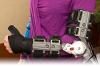 Photo for Global Orthopedic Devices Market to reach at $82.5 Billion by 2022 - By Market Research Engine