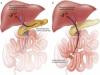 Photo for Neuroendocrine Carcinoma Clinical Trials Review 2016 By Global Market Research Store