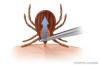 Photo for Ticks Pest Control