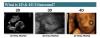 Photo for Ultrasound and Sonogram - First Look Sonogram