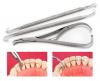 Photo for Global Dental Consumables Market will cross US$31.40 Billion Mark by 2022