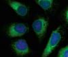 Photo for Live Cell Imaging Market Projections And Current Trends
